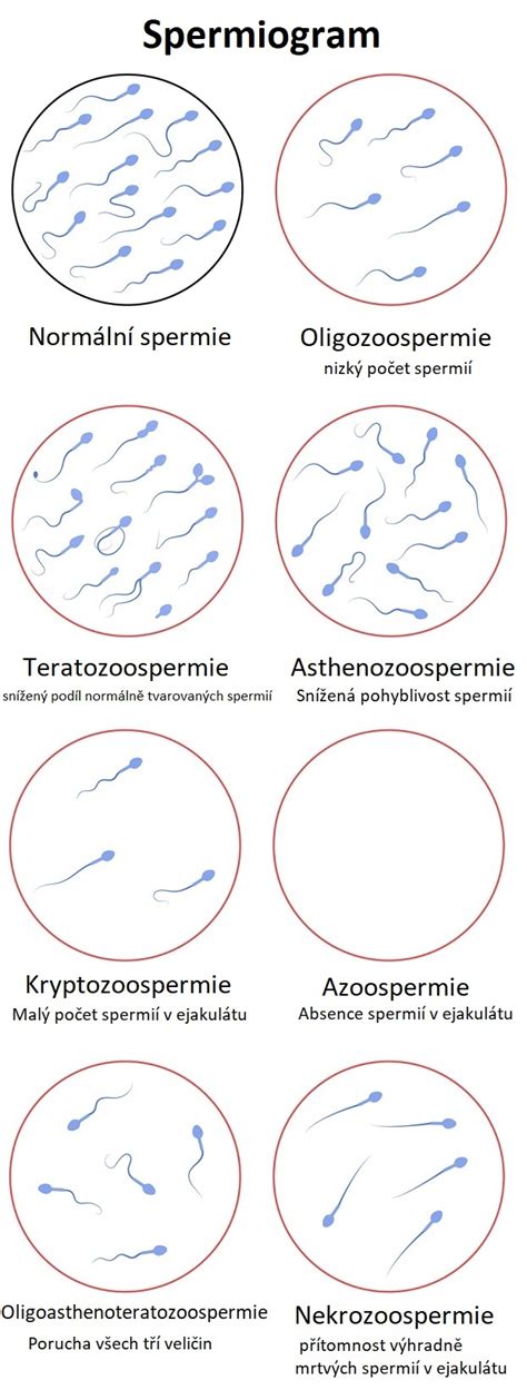 Porovnanie kvality spermií v rôznych obdobiach