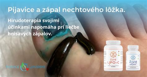 Príčina vzniku zápalu nechtového lôžka