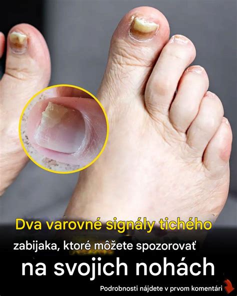 Kedy navštíviť lekára pri zápale prsta